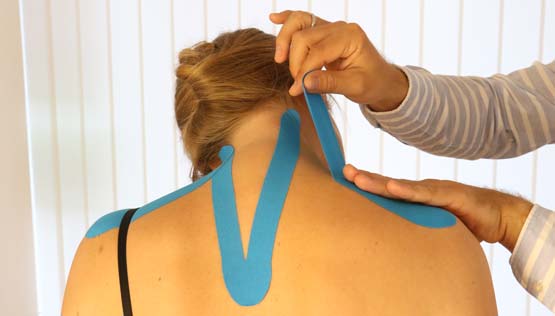 Kinesio Tape als Behandlungstechnik in der Physiotherapie